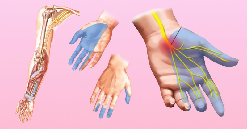 Почему немеют руки: 7 причин, заставляющих задуматься о здоровье