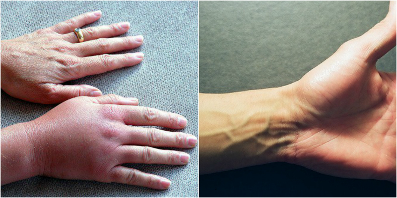 Почему немеют руки: 7 причин, заставляющих задуматься о здоровье