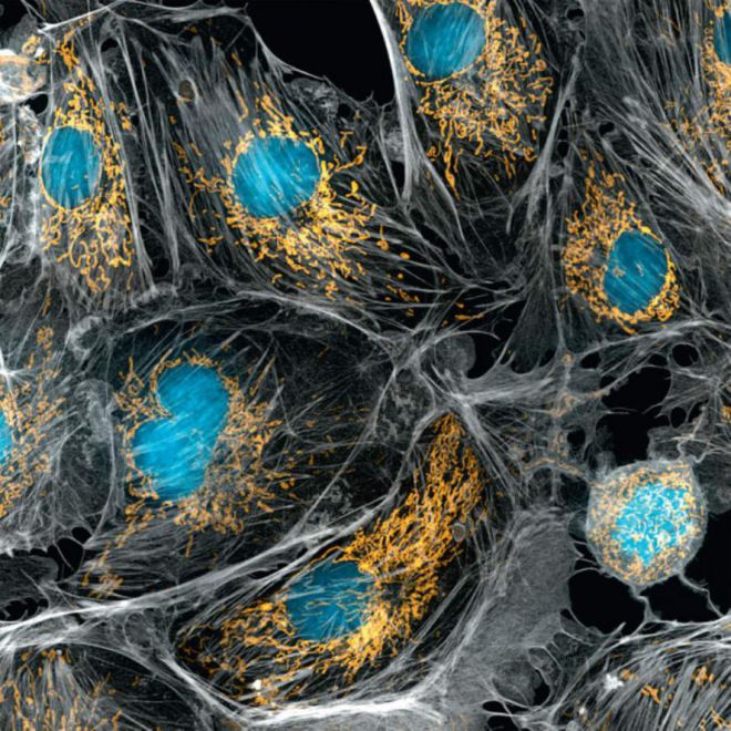 Познай себя: 23 захватывающих фото человеческих органов под микроскопом