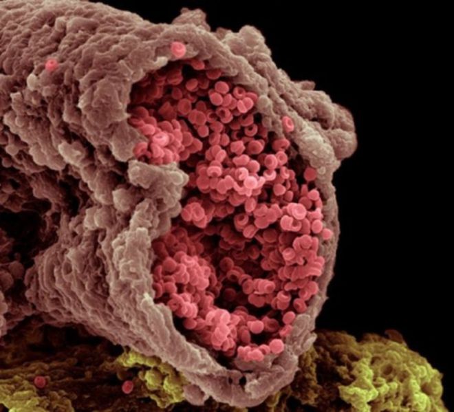 Познай себя: 23 захватывающих фото человеческих органов под микроскопом